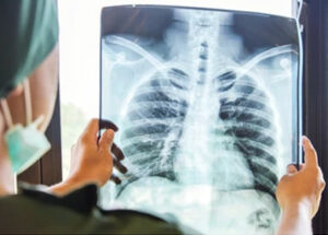 X Ray Testing Service At Home in Thane