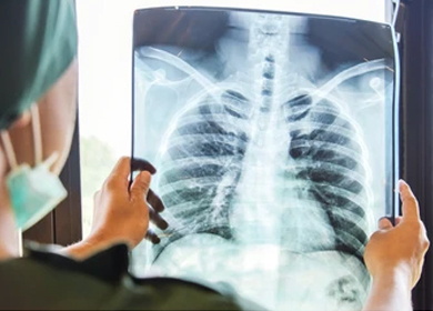 x-ray